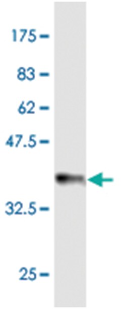 PON1, Mouse, Clone: 4C7, Abnova 100 &mu;g | Buy Online | Abnova Corporation | Fisher Scientific