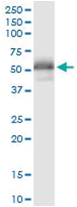 anti-POU2F2, Human, IP-WB Antibody Pair, Abnova™