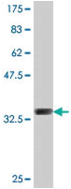 POU3F3, Mouse, Polyclonal Antibody, Abnova 50&mu;L; Unlabeled:Antibodies,