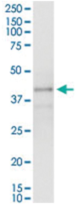 anti-POU4F3, Human, IP-WB Antibody Pair, Abnova 1 Set:Antibodies, Monoclonal/Polyclonal