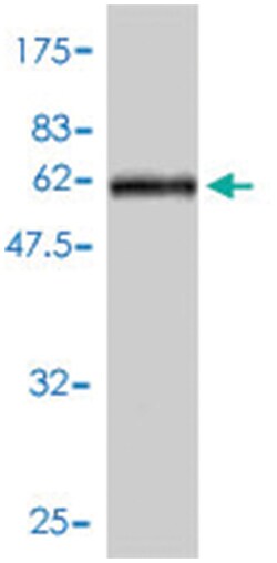 PPARD (A01), Mouse anti-Human, Polyclonal Antibody, Abnova 50&mu;L; Unlabeled:Antibodies,