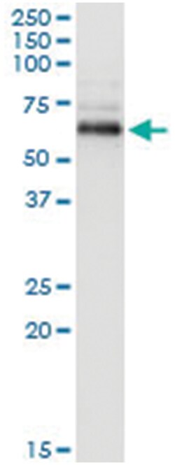 anti-PPM1B, Human, IP-WB Antibody Pair, Abnova&trade;