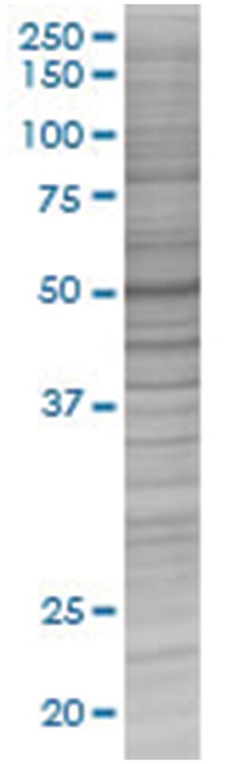 PPM1B 293T Cell Overexpression Lysate (Denatured), Abnova 100&mu;L | Buy Online | Abnova | Fisher Scientific