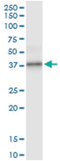 anti-PPP1R3C, Human, IP-WB Antibody Pair, Abnova 1 Set:Antibodies, Monoclonal/Polyclonal