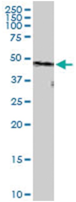 anti-PPP2R1B, Human, IP-WB Antibody Pair, Abnova 1 Set:Antibodies, Monoclonal/Polyclonal