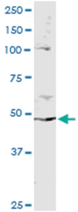Abnova PPP2R2B, Human, IP-WB Antibody Pair (PW1), Abnova™