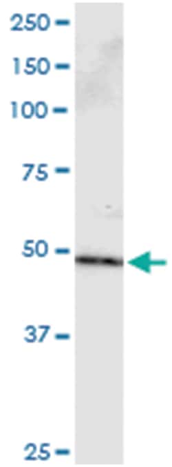 PPP2R2B, Human, IP-WB Antibody Pair (PW2), Abnova™