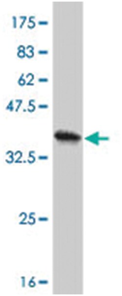 PPP4C, Mouse, Polyclonal Antibody, Abnova 50&mu;L; Unlabeled:Antibodies,