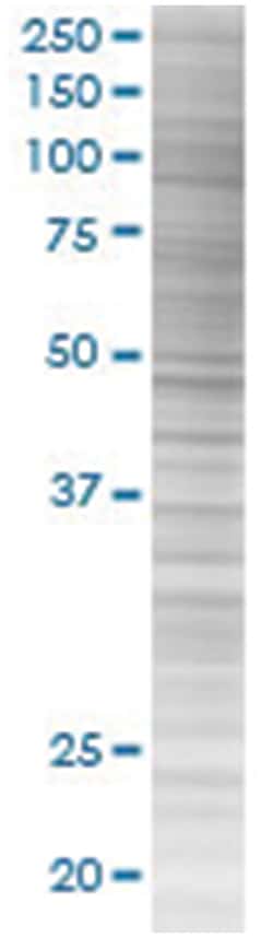 PPP3R2 293T Cell Overexpression Lysate (Denatured), Abnova 100&mu;L | Buy Online | Abnova | Fisher Scientific