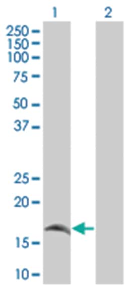 PPP3R2 293T Cell Overexpression Lysate (Denatured), Abnova 100&mu;L | Buy Online | Abnova | Fisher Scientific