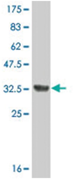 PRELP, Mouse, Clone: 3H1, Abnova 200&mu;L; Unlabeled:Antibodies, Monoclonal