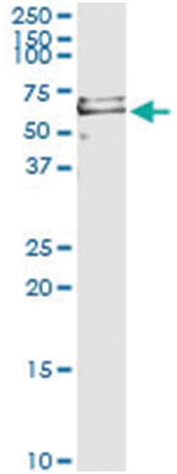 PRF1, Human, IP-WB Antibody Pair (PW2), Abnova&trade;