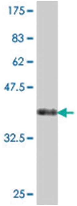 PRKAR2B, Mouse, Polyclonal Antibody, Abnova 50&mu;L; Unlabeled:Antibodies,