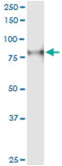 anti-PRKCH, Human, IP-WB Antibody Pair, Abnova&trade;
