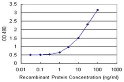anti-PRKCSH Matched Antibody Pair, Abnova™