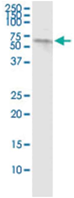 anti-PRKCSH, Human, IP-WB Antibody Pair, Abnova&trade;