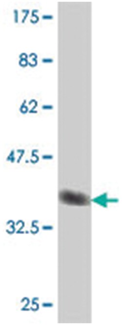 PRKG1, Mouse, Polyclonal Antibody, Abnova 50&mu;L; Unlabeled:Antibodies,