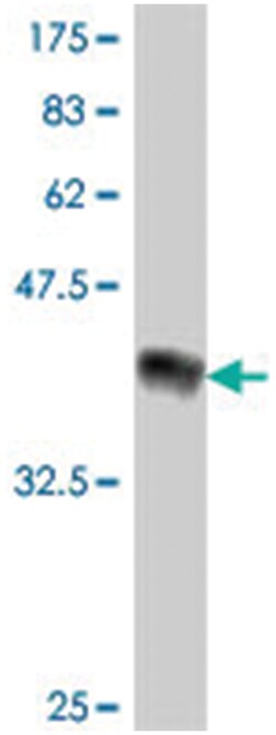 protein kinase, cGMP-dependent, type II, Mouse, Polyclonal Antibody, Abnova&trade;