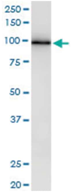 anti-MAPK6, Human, IP-WB Antibody Pair, Abnova™