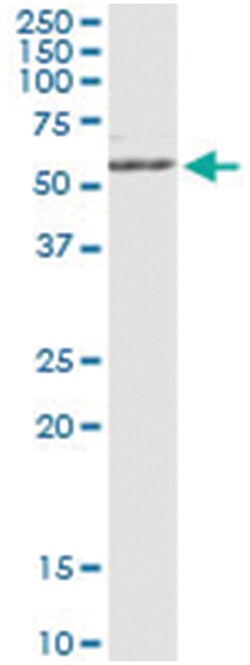MAPK8, Human, IP-WB Antibody Pair (PW2), Abnova™