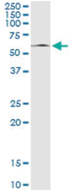 MAPK8, Human, IP-WB Antibody Pair (PW3), Abnova 1 Set:Antibodies, Monoclonal/Polyclonal