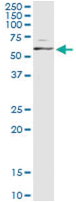MAPK8, Human, IP-WB Antibody Pair (PW4), Abnova&trade;