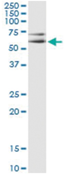 MAPK8, Human, IP-WB Antibody Pair (PW5), Abnova&trade;