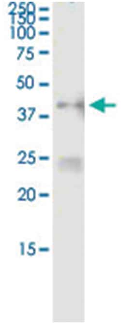 anti-MAPK11, Human, IP-WB Antibody Pair, Abnova&trade;