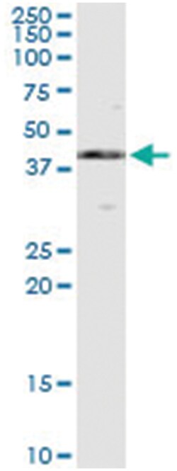 MAPK13, Human, IP-WB Antibody Pair (PW1), Abnova&trade;