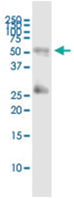anti-MAP2K2, Human, IP-WB Antibody Pair, Abnova&trade;