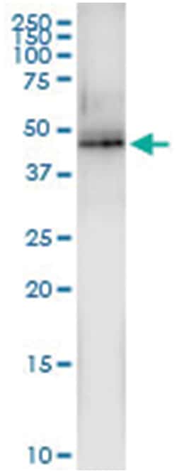 anti-MAP2K5, Human, IP-WB Antibody Pair, Abnova™