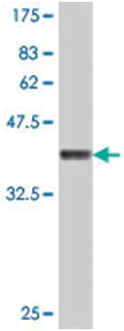 MAP2K6, Mouse, Polyclonal Antibody, Abnova 50&mu;L; Unlabeled:Antibodies,