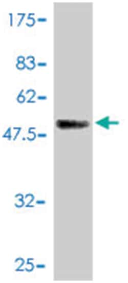 DNAJC3, Mouse, Polyclonal Antibody, Abnova 50&mu;L; Unlabeled:Antibodies,