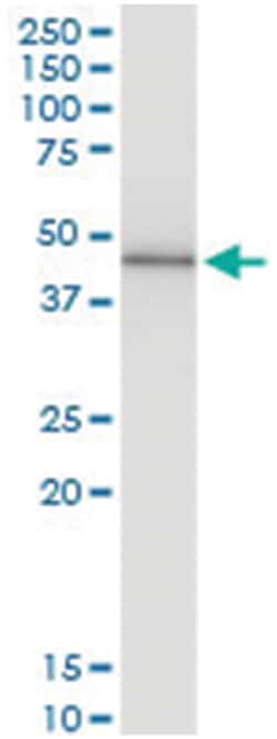 PRKX, Human, IP-WB Antibody Pair (PW1), Abnova 1 Set:Antibodies, Monoclonal/Polyclonal