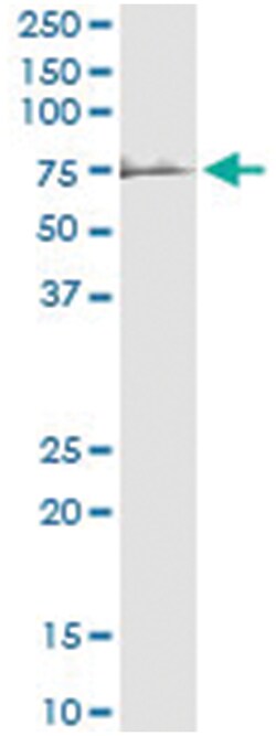 anti-PROC, Human, IP-WB Antibody Pair, Abnova 1 Set:Antibodies, Monoclonal/Polyclonal