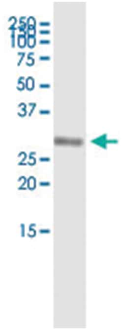 anti-PROP1, Human, IP-WB Antibody Pair, Abnova&trade;