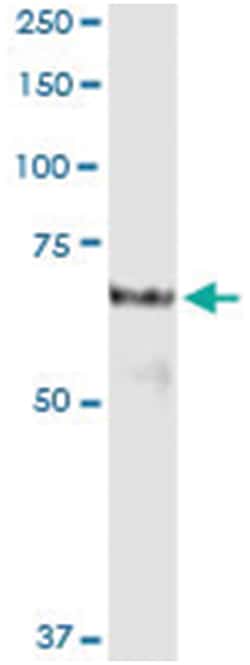 anti-PROS1, Human, IP-WB Antibody Pair, Abnova&trade;