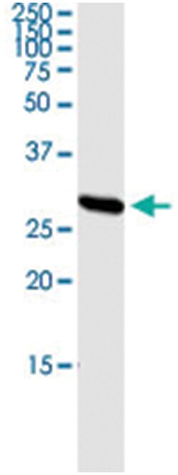anti-PRSS1, Human, IP-WB Antibody Pair, Abnova™