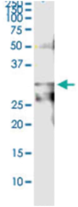 anti-KLK7, Human, IP-WB Antibody Pair, Abnova&trade;