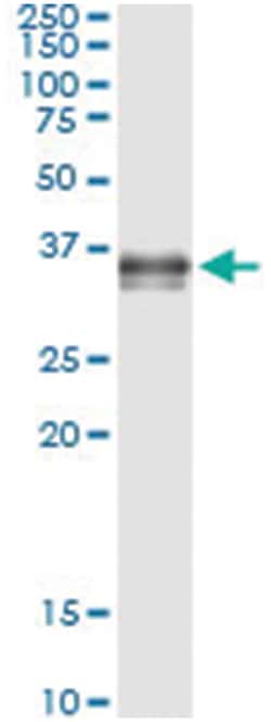 anti-PRSS8, Human, IP-WB Antibody Pair, Abnova 1 Set:Antibodies, Monoclonal/Polyclonal