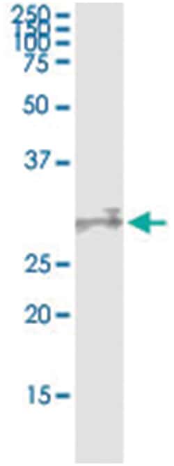 anti-KLK10, Human, IP-WB Antibody Pair, Abnova&trade;