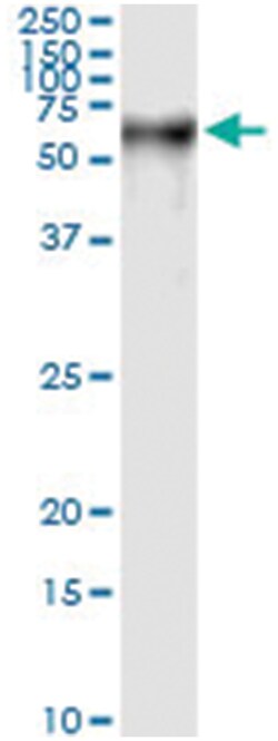 PSAP, Human, IP-WB Antibody Pair (PW1), Abnova&trade;