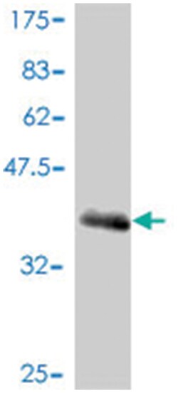presenilin 1, Mouse, Polyclonal Antibody, Abnova 50&mu;L; Unlabeled:Antibodies,