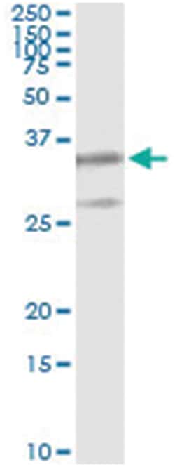 PSMB8, Human, IP-WB Antibody Pair (PW2), Abnova 1 Set:Antibodies, Monoclonal/Polyclonal