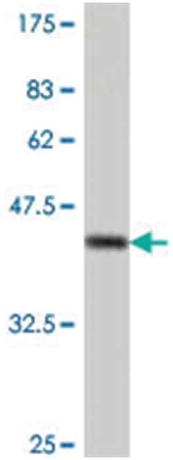 PSMD1, Mouse, Polyclonal Antibody, Abnova 50&mu;L; Unlabeled:Antibodies,