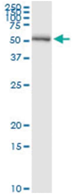 anti-PSMD5, Human, IP-WB Antibody Pair, Abnova 1 Set:Antibodies, Monoclonal/Polyclonal