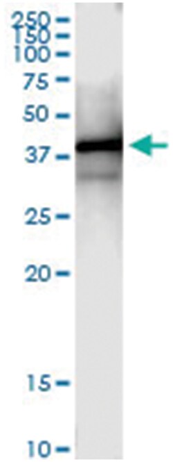 anti-PSMD7, Human, IP-WB Antibody Pair, Abnova™