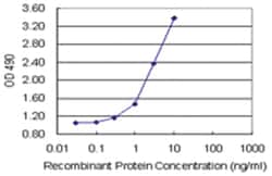 anti-PSMD9 Matched Antibody Pair, Abnova