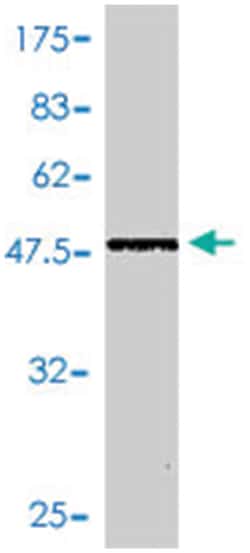PSME2, Mouse, Polyclonal Antibody, Abnova 50&mu;L; Unlabeled:Antibodies,