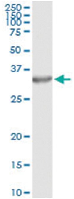anti-PSME2, Human, IP-WB Antibody Pair, Abnova™